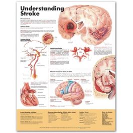Pocket_Nurse's tweet photo. Featured product for #NDWeek2018: Understanding Stroke Chart. https://t.co/3SJaXjvWGd https://t.co/TTAyLGbuKV