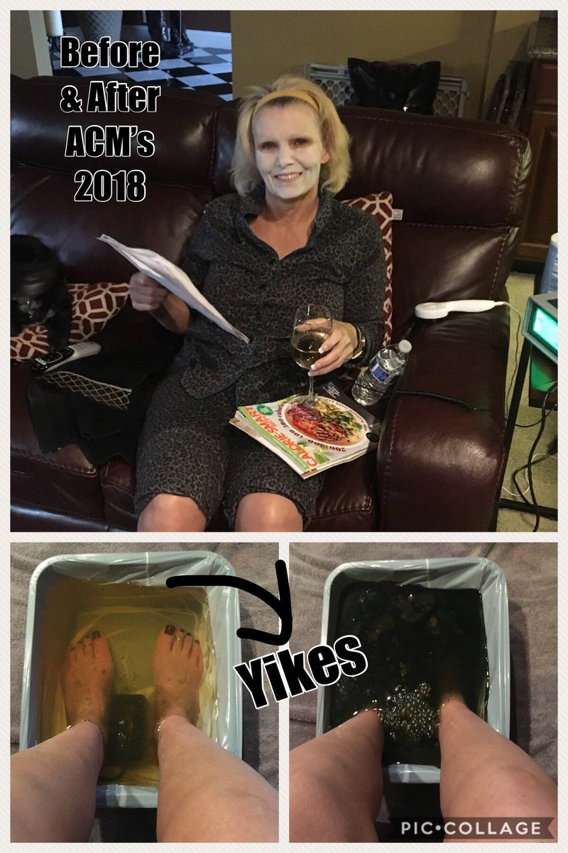 TinaFerguson's tweet photo. It was a great trip but man it’s rough when you come back and see what your organs think about you and your fun weekend!#noregrets#lovemylife https://t.co/w1zGGwUzAn