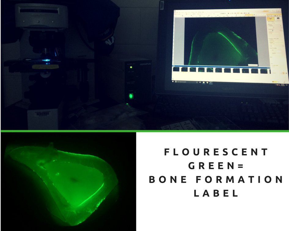 Ph_commDy's tweet photo. Did some cool work today looking at bone formation. As new bone is formed, we can mark this formation with fluorescent labeling. By measuring how much surface is labeled &amp; the distance between subsequent labels, we can look for changes in health and disease . #Cornellengcomm https://t.co/oLrIhq8axX