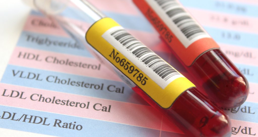 WebMD's tweet photo. So you've had your cholesterol tested -- what do the levels actually mean? https://t.co/sq8LGOKBy9 https://t.co/P1rhpcyO0K