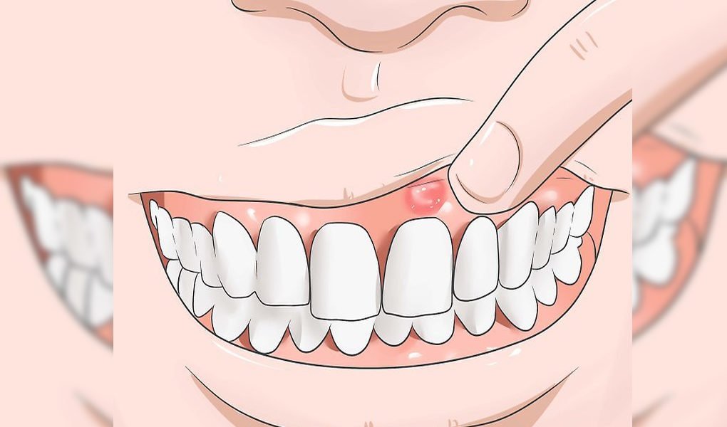 DrFarrahMD's tweet photo. Have you experienced an episode of gum swelling and just couldn’t concentrate on your job? https://t.co/0OeKtAl2IN
#DrFarrahMD #cancercure #bostonc #naturaloncology 🇵🇭 https://t.co/nEqh4D4tv2 ⚕️ 09189151284 https://t.co/TlqShy5DwK