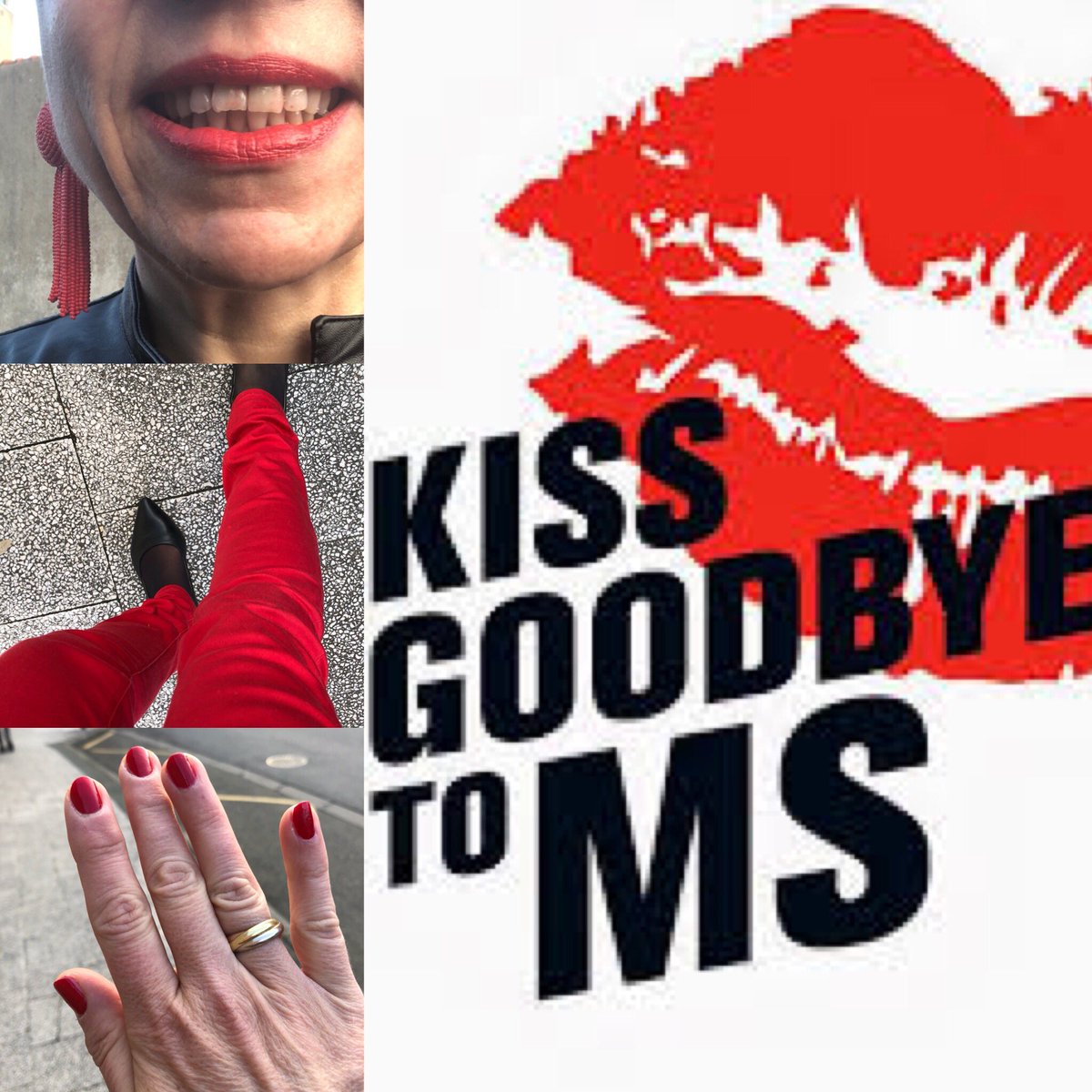 hvidalis's tweet photo. Au CHIPS, je porte du rouge ce 5 avril pour la recherche contre la sclérose en plaques #unbaiserdadieualasep https//bit.ly/2EDLI1T https://t.co/771R8vXYDq