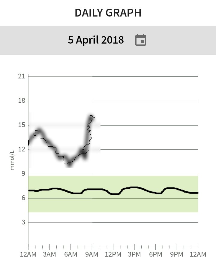 shootuporputup's tweet photo. Look at my #Libre results today. Totally flat and so I'm the best diabetic ever!! #fullofwin #bestdiabetic #notphotoshopped #epic #awesome #amazing #remarkable #wonderful #incredible #startling #mindblown #staggering #thesaurus https://t.co/tYlfSZrXvC