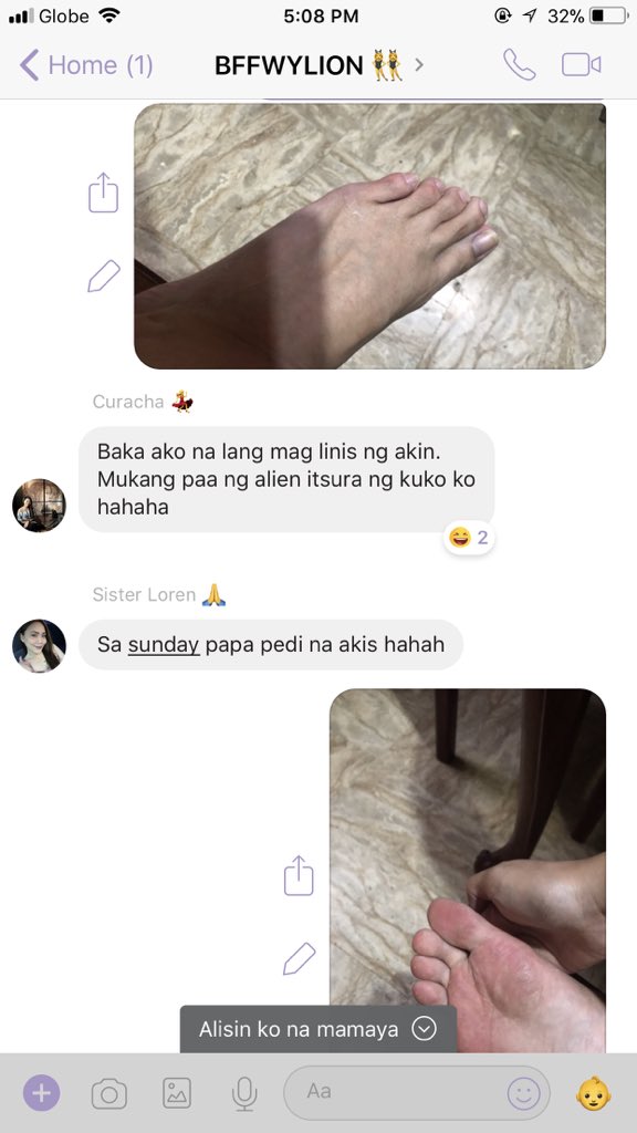 annecleck's tweet photo. Usapang paa 😂 Pedi problems 😅 #HirapMagingBabae #AngGastosniAteGirl #PediParty #EhKasiBabae dami kong hashtags 🤣 https://t.co/R24lcHtllh