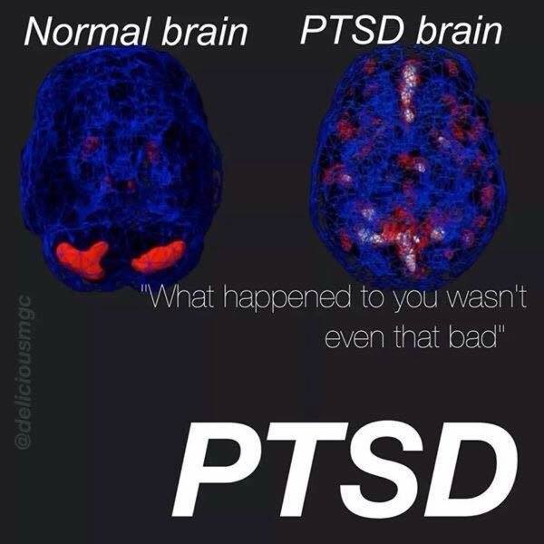 PtsdMe's tweet photo. #MentalHealthMatters 
#Breakthestigma https://t.co/of4wwNPoy5