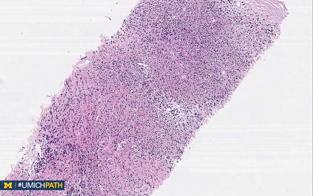 Michigan Pathology tweet media