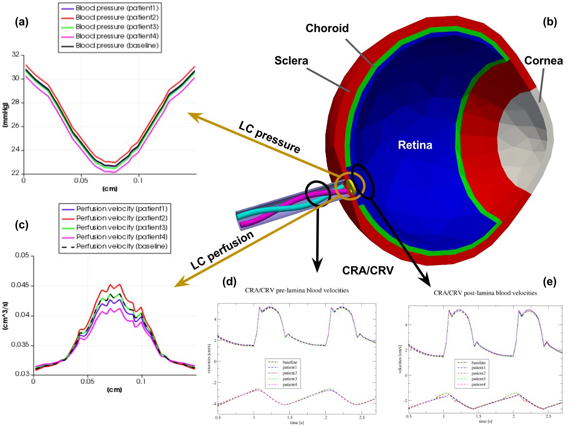 mso4sc's tweet photo. #Eye2Brain, one of our #MSO4SC pilots from #CEMOSIS #UNISTRA, uses the eye as window to the brain offering non-invasive access to biomarkers that might help in the early diagnosis and clinical care of #neurodegenerative diseases. https://t.co/l5yoDpNgdq