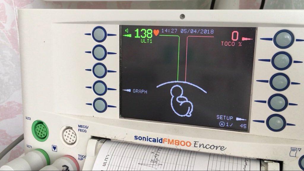 Nikita_st's tweet photo. We have a Trance Baby on her way #WhosAfraidOf138 #Trancefamily #ArminVanBuuren @MikeEmery_ @arminvanbuuren #WatersBroken #AwesomeHeartRate https://t.co/2KNLG5MX1l