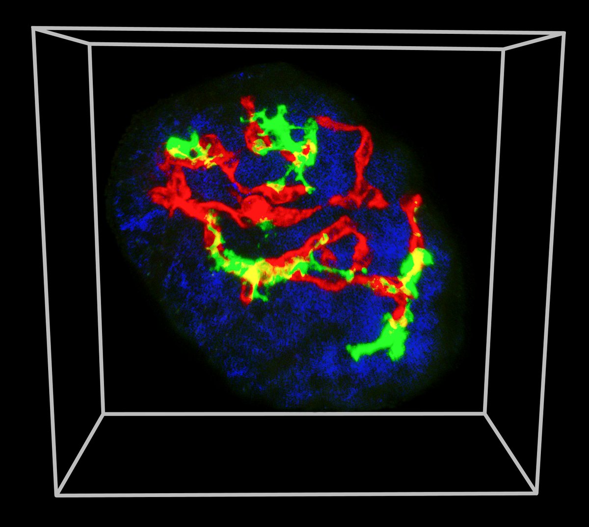 DiabetologiaJnl's tweet photo. Deep 4-dimensional #2PMicroscopy of intact murine #isletsofLangerhans revealed that their resident #Macrophages are constantly probing their local environment capturing #betacell granules and blood particles #2photon #Microscopy #diabetes #NODmice https://t.co/n1JoVjrYSO https://t.co/vFRLXIjVTV