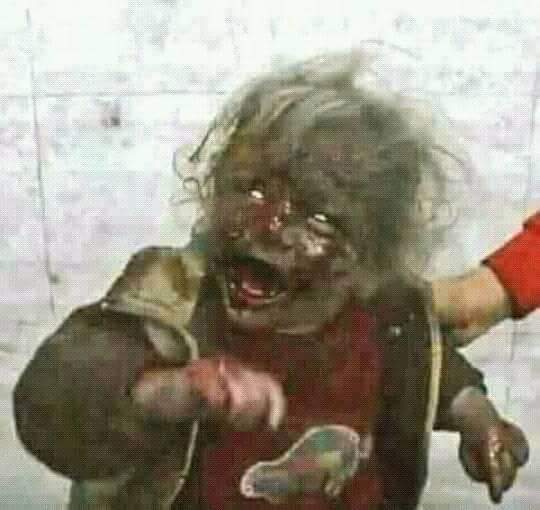 RereAbdullah8so's tweet photo. #هذه الصوره ليست في الخيال ولارسم فنان انها صوره لطفله يمنيه الوحيده الناجيه من اسرتها بسبب قصف منزلهم في صعده بطيران العدوان السعودي .. https://t.co/FV9RApIIdu