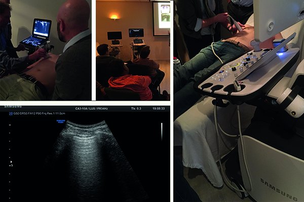 Inspirerend, interessant en een eyeopener voor de echograferende huisarts. Cursus POCUS-Long in de huisartspraktijk was zeer succesvol. Laat u informeren over een volgende editie!