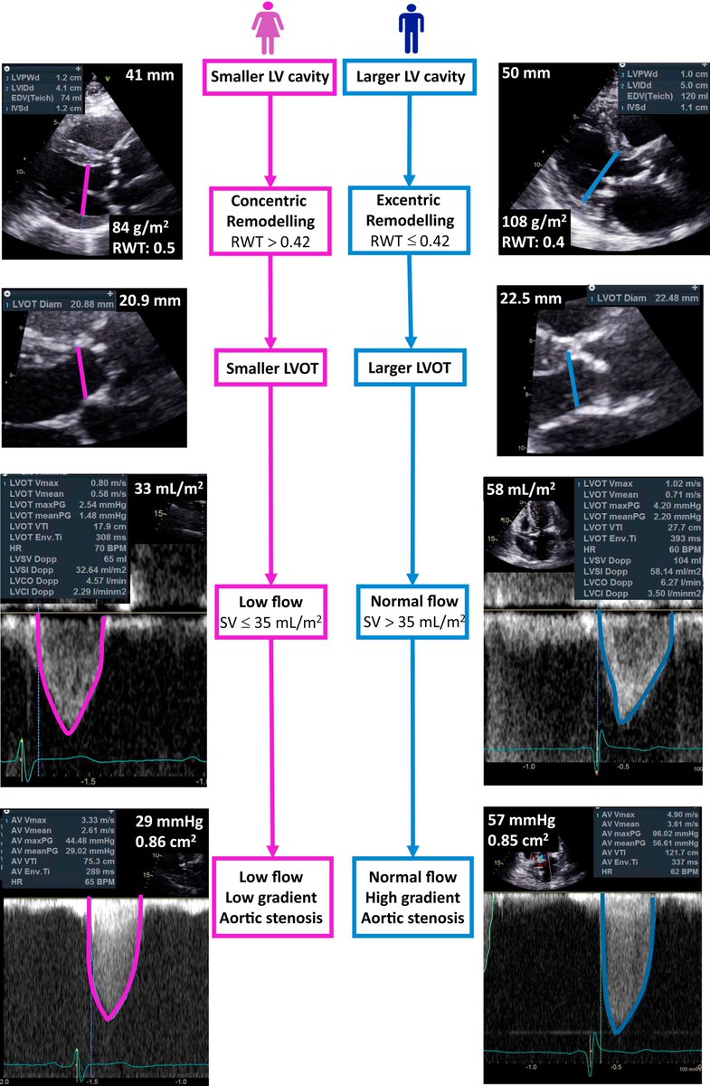 CJC Journals (@cjcjournals) on Twitter photo Click here for a comprehensive review on #TAVR in the #women population #womenshearthealth @SCC_CCS_CJC @cpachecoMD #HotOfThePress bit.ly/2q93iUJ Click here for a comprehensive review on #TAVR in the #women population #womenshearthealth @SCC_CCS_CJC @cpachecoMD #HotOfThePress bit.ly/2q93iUJ