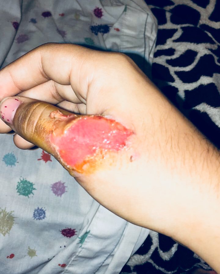 rt o te pasa esto ahRE