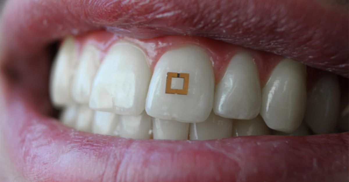 paulpaetz's tweet photo. Tooth-Mounted Sensors Track your Diet from Inside Your Mouth https://t.co/rGAQoVscXx #wearables #sensors #diettracker #healthtracker #biomarkers https://t.co/2krQR16wRe