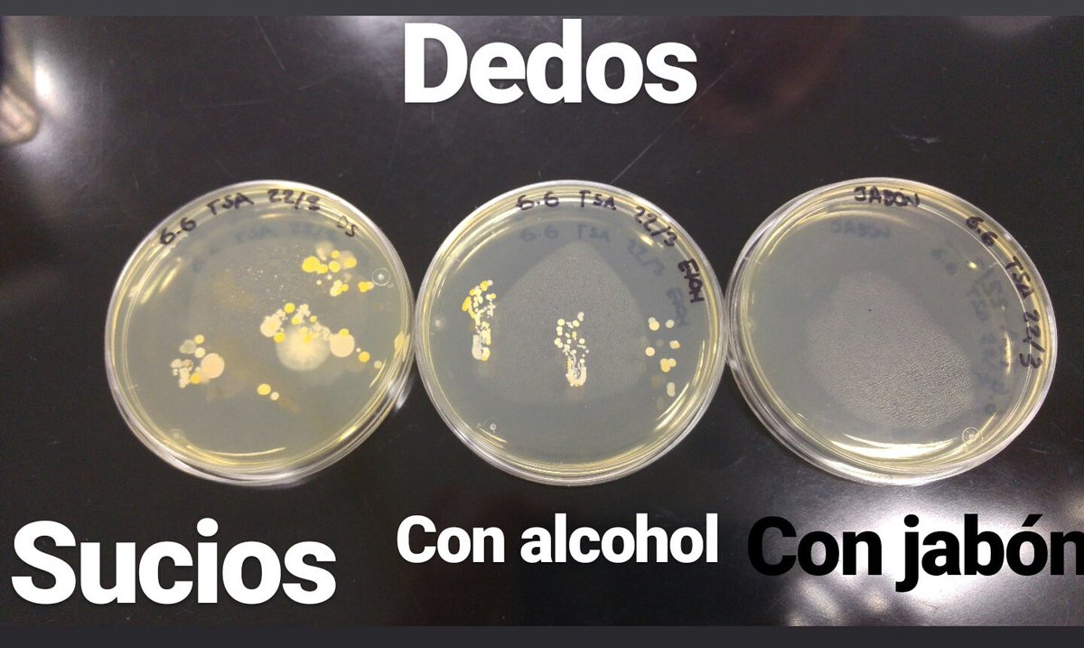 Como el agua y jabón no hay!
Lo que se ve en la foto son colonias de bacterias que están en nuestras manos, creciendo en placas de agar. <a href="/Tomirods/">Tomás Rodríguez</a>