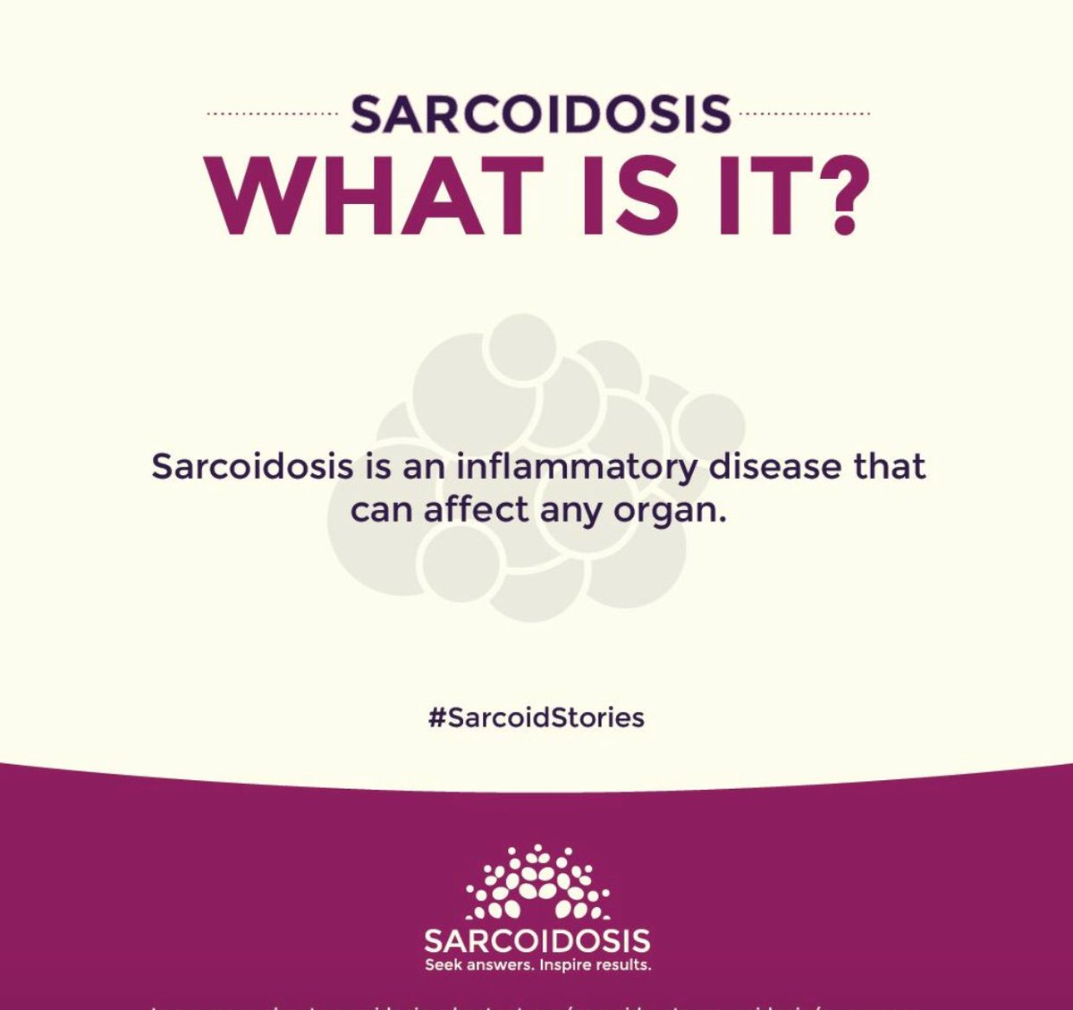 #Sarcoidosis is an inflammatory disease of unknown origin that can affect almost any organ in the body. It occurs when a person’s immune system overreacts resulting in the formation of granulomas, microscopic clumps of inflammatory cells.
#SarcoidStories