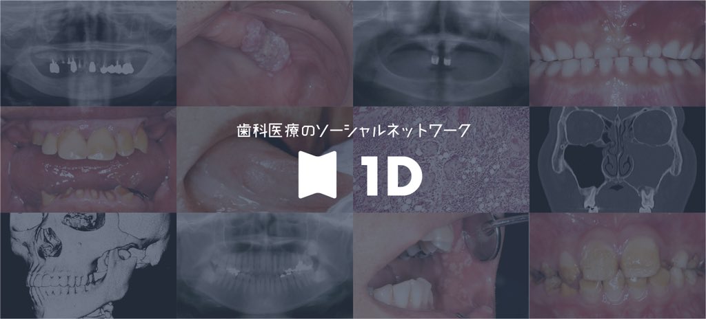 歯科医療者のためのSNSを、2018年夏にリリースします🔥
本日、事前登録を開始しました。
#歯科医師 #歯科衛生士 #歯科技工士 #歯学部 の人は、今すぐ事前登録！

➡️oned.jp