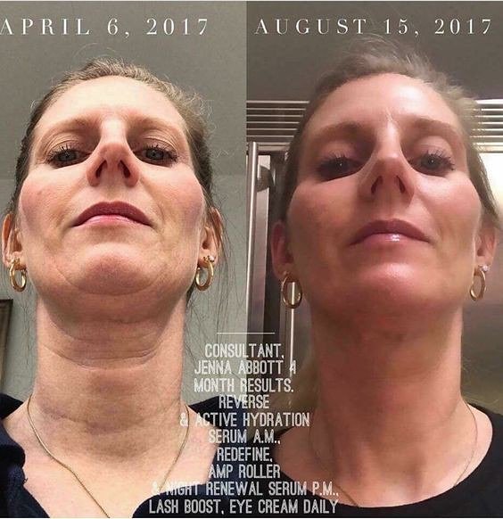 JTHayworth1's tweet photo. You guys I love what I do because I'm able to help people get amazing results like this! Let me help you get your best skin and get 10-25% off and a free 60 day money back guarantee! #rodanandfields #skincare #beauty https://t.co/k1U4nnNBLM