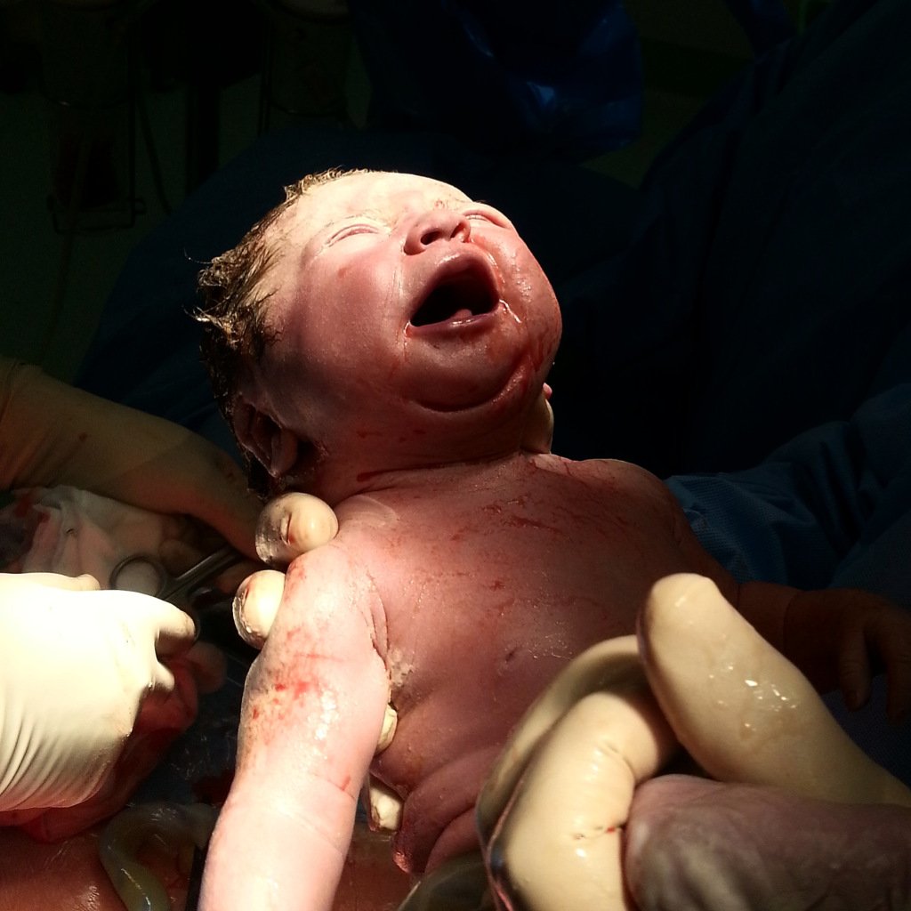 themummycode's tweet photo. C-section awareness month https://t.co/fETypE0pzQ https://t.co/bvsUtDyQOZ