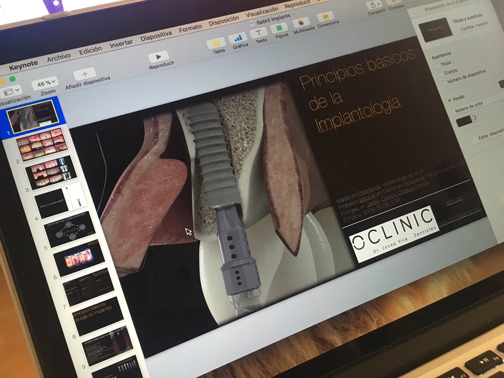 jepivila's tweet photo. Conference💪🏽💪🏽💪🏽💪🏽 @StraumannES #implants #implantology #periodoncia https://t.co/UXsZ4IEX1h