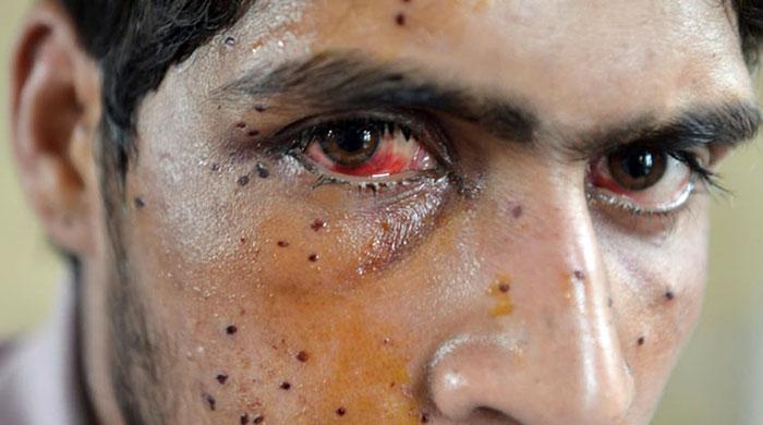 nonstopm4301's tweet photo. @GautamGambhir @SAfridiOfficial @UN look at this pic and what you think they are terrorist.what the Indian army doing in Kashmiri and you tell pakistan support terrorism in Kashmir. https://t.co/uzEoaQHTqM