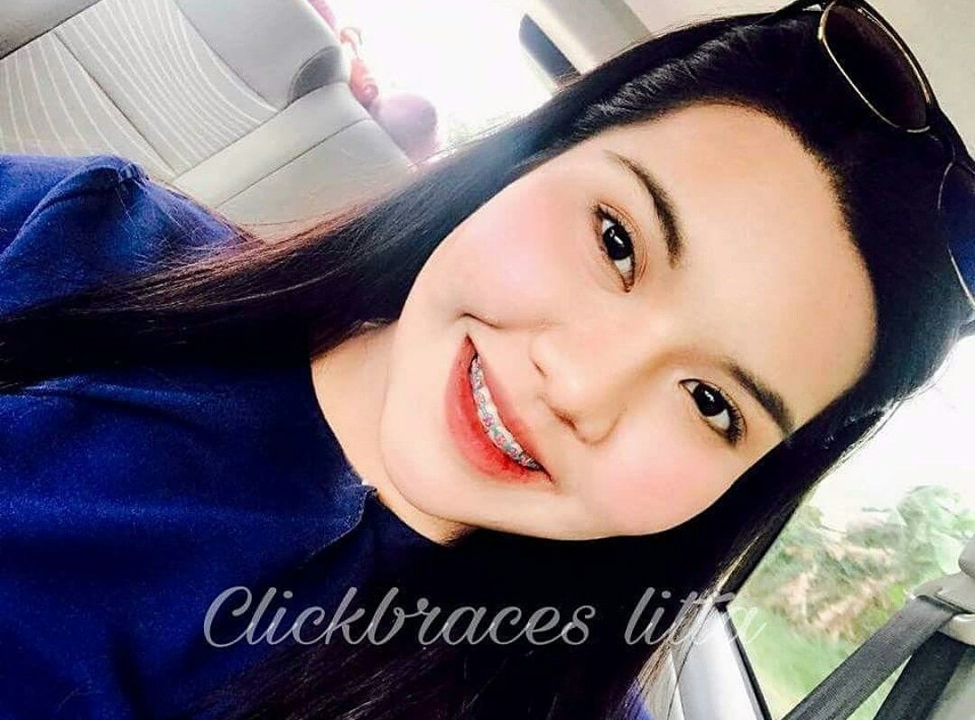 NerusCar's tweet photo. ANDA SEDANG MENCARI CLICK BRACES?
✅SESUAI DIGUNAKAN OLEH GIGI YANG DAH SEDIA TERSUSUN SAHAJA
✅MUDAH DIPAKAI DAN DIBUKA
✅HANYA SEBAGAI AKSESORI UTK KELIHATAN CANTIK

KALAU TERINGIN NAK PAKAI BRACES TP MERASA MAHAL BOLEH TRY YANG NI😍.
SELFIE PUN CANTIK. WHASSAPP SIS  0196301357 https://t.co/EZGyYddCl1