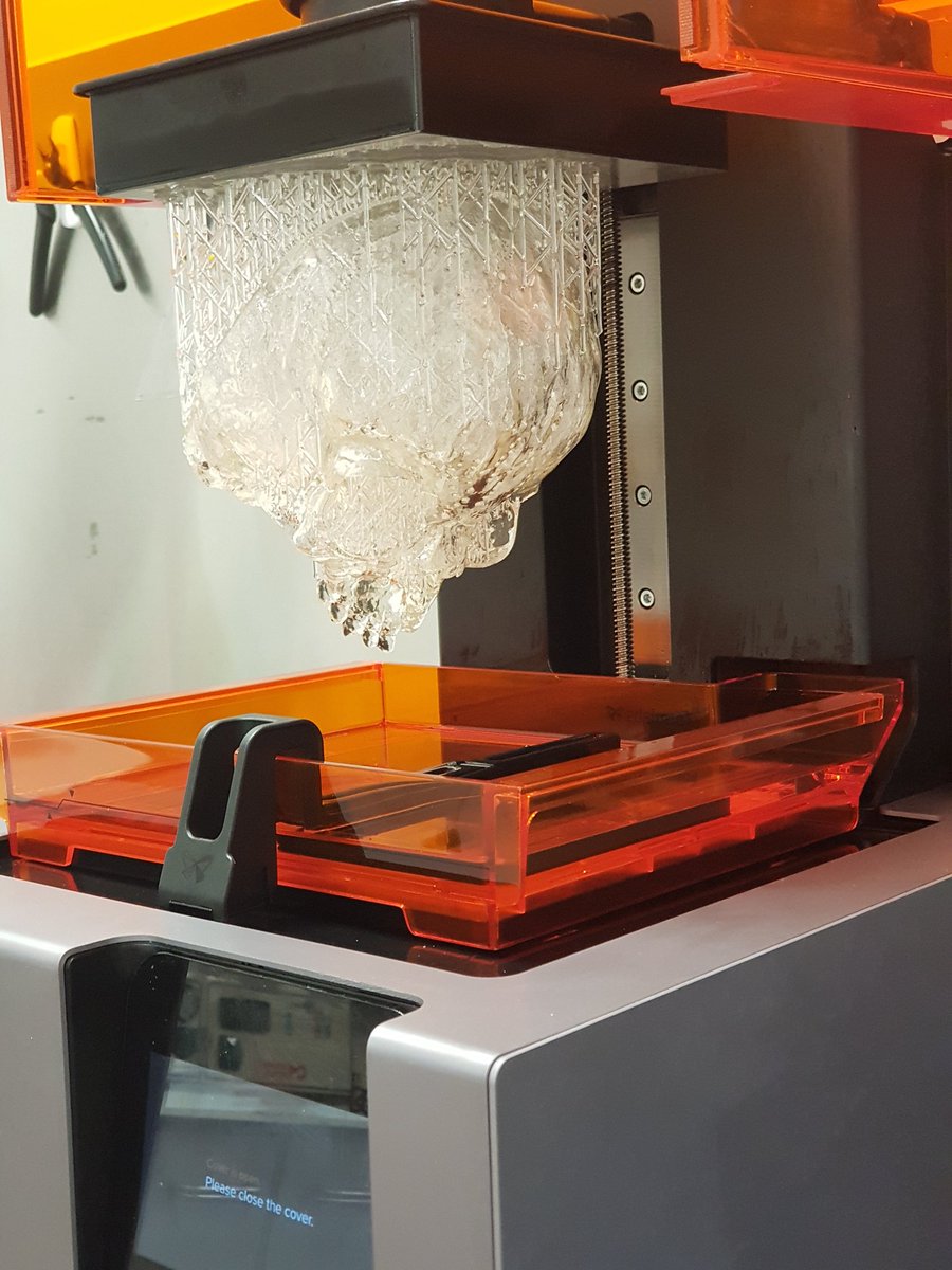 maxillo's tweet image. Formlabs,  Form 2 producing fantastic prints.