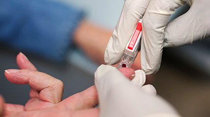 JournalHep's tweet photo. #HCV finger-stick #testing accurate, gives results in 1 hour https://t.co/CGYWWxNEQK https://t.co/VJWbUMO9Ir