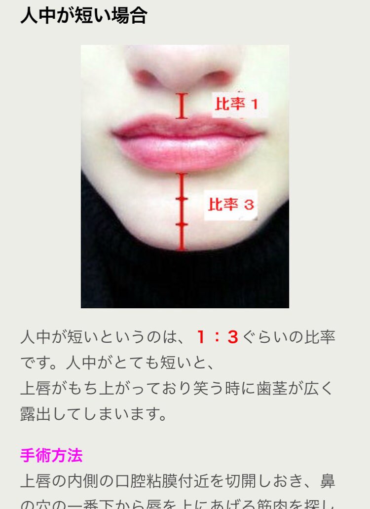 高嶺の花子さん 人中の長さ人より長いのか短いのか気になって調べたら黄金比率の1 2だった 短ければいいと思ってたけどそうでもないんだね 遺伝子に感謝 T Co Axnhtiaqie Twitter