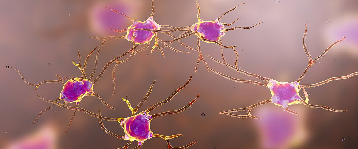 CROWRDREAM's tweet photo. Chronic Stress Drives Immune Cells to Remodel Neural Circuits, Possibly Promoting Anxiety and Depression - https://t.co/3S2kqDJpad https://t.co/pcDvwosGRa