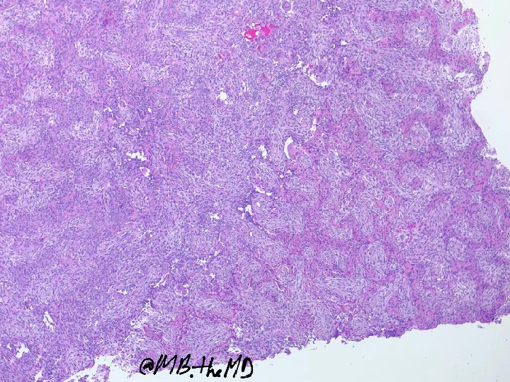 MB_thepathMD's tweet photo. #pathology #pathologists #pathresident #pathcases #pathArt https://t.co/3XjmU5rCQj