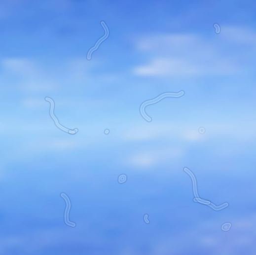 Seeing "floaters" across your visual field? Simon Eye Associates explains their possible causes here. bit.ly/2pfm7WK