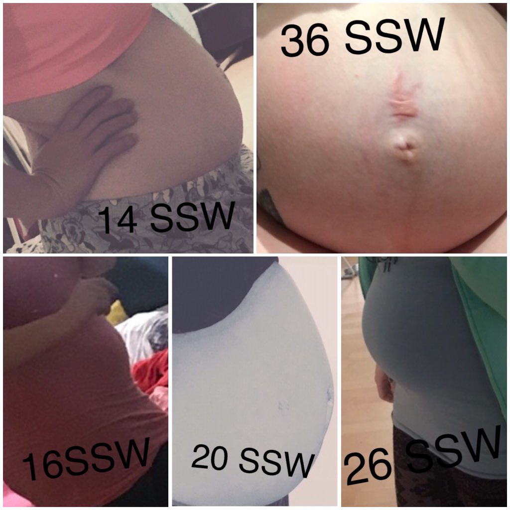 Annie_Kapanoisz's tweet photo. Now 38+3 ❤️ #pregnancy #pregnant #babyboy https://t.co/wy4ZRLoqun