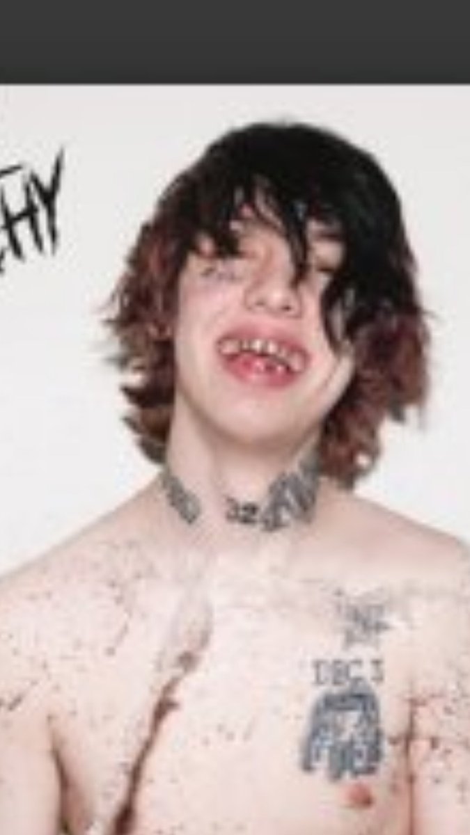 JxmesYoungBlood's tweet photo. @EnticeTheLemon @lilxanfuhyobih Wtf is that https://t.co/muaoUtaBzW