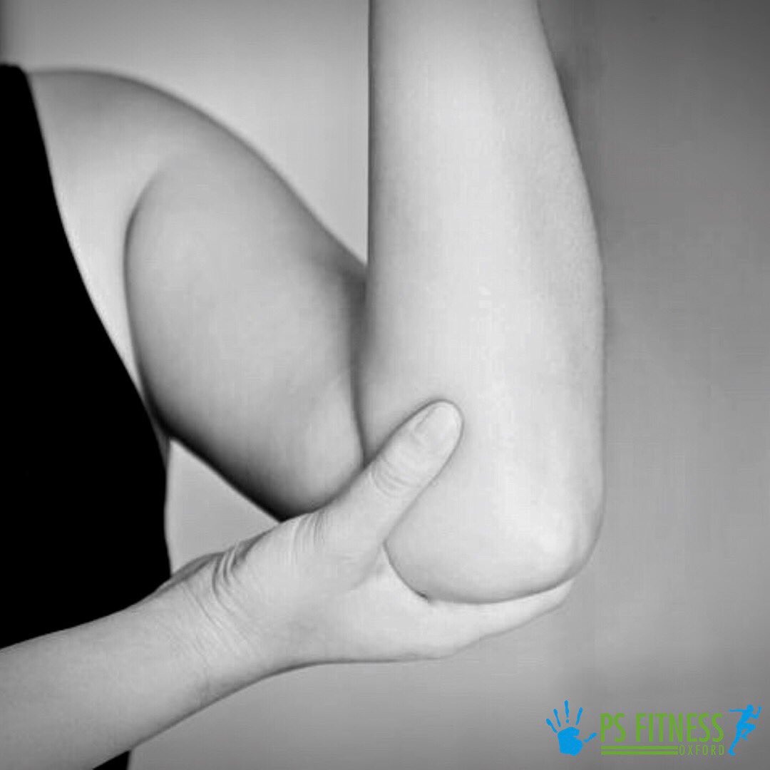 PSFITNESSOXFORD's tweet photo. Tennis elbow causes #pain around the outside of the #elbow. There are many other #activities which can cause #tennis elbow:
🔹Manual jobs – plumbing, carpentry, bricklaying etc.
🔹Prolonged use of computer keyboard /mouse
🔹Weight lifting
Sports #massage can help promote recovery https://t.co/1VL8CASZa7