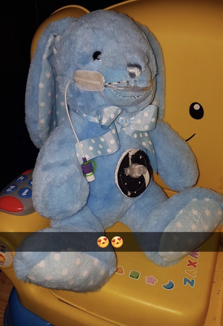 Ashjanexxx's tweet photo. My nephew Harleyโs little tubie friends my sister made him with his favourite teddy bears ... such an amazing little boy!๐ Always has a smile on his face no matter what!โค๏ธ #itsokaytobedifferent #PEGFED ๐ https://t.co/GTVSBU8dJd