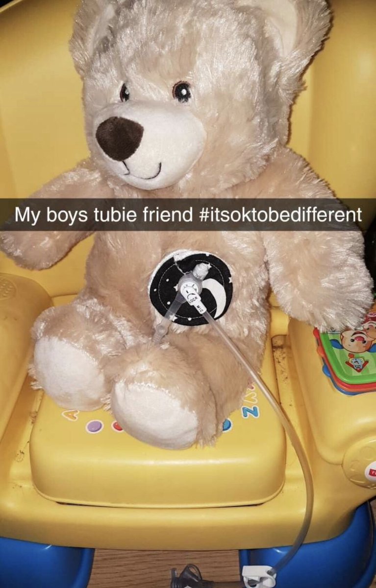 Ashjanexxx's tweet photo. My nephew Harleyโs little tubie friends my sister made him with his favourite teddy bears ... such an amazing little boy!๐ Always has a smile on his face no matter what!โค๏ธ #itsokaytobedifferent #PEGFED ๐ https://t.co/GTVSBU8dJd