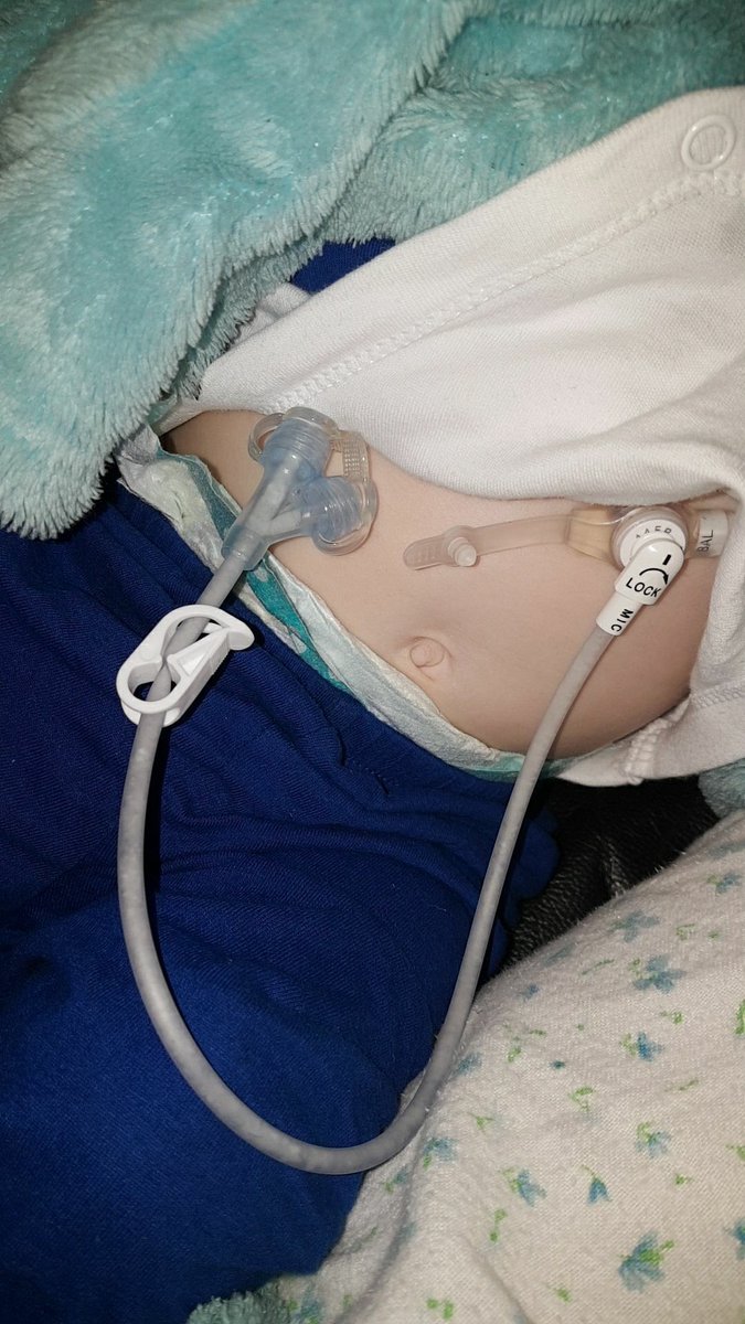 Ashjanexxx's tweet photo. My nephew Harleyโs little tubie friends my sister made him with his favourite teddy bears ... such an amazing little boy!๐ Always has a smile on his face no matter what!โค๏ธ #itsokaytobedifferent #PEGFED ๐ https://t.co/GTVSBU8dJd