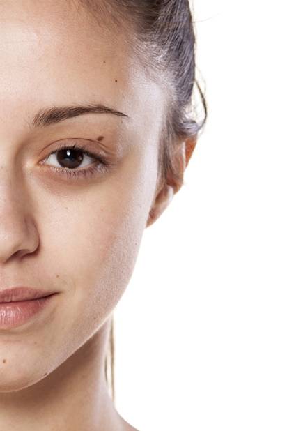 FCSkinSolution's tweet photo. Sensitive skin around #eyes is often neglected. Eye bags can be reduced safely and effectively using medical-grade #dermalfillers.
#fcskinsolution #vancouver #skincare #antiaging #youthful #eyebags #eyecream
https://t.co/KH17hbu7bm https://t.co/xqenPfB18W