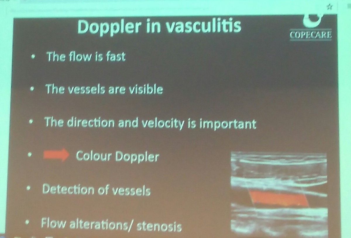 DrQasimAkram's tweet photo. Nice slide- Doppler principles in inflammatory arthritis vs vasculitis https://t.co/ykUQvB8KwB