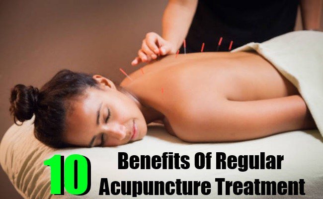 lifemartini's tweet photo. 10 Benefits Of Regular Acupuncture Treatment
https://t.co/ZJKSDJhhkr
#benefits #regularacupuncturetreatment #acupuncturetreatment https://t.co/hQMyNMPE03