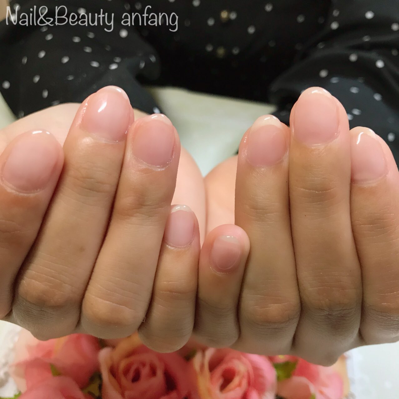 Anfang Mika 深爪気味だったお客様 ネイルベッド お爪のピンクの部分 が大分育ちました まだまだ育成中 Anfang 町田 町田ネイルサロン Nail Nails Nailart Naildesigns Gelnail 巻爪ケア 深爪 深爪矯正 Nudie Beige Pink 透け感の