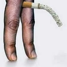 Gidi_Traffic's tweet photo. #DidYouKnow that smoking is the leading cause of erectile dysfunction for men under 40?. Healthy reactions require a healthy blood supply and flow. Smoking leads to plaque build-up in the arteries which obstructs regular flow. Stay Healthy. https://t.co/PTwe7VbBme