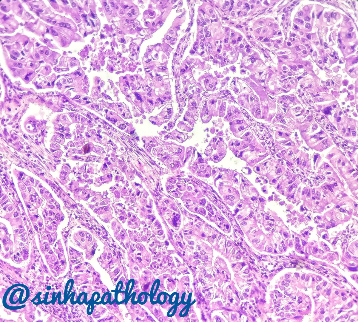 Anshuman Sinha MD tweet media