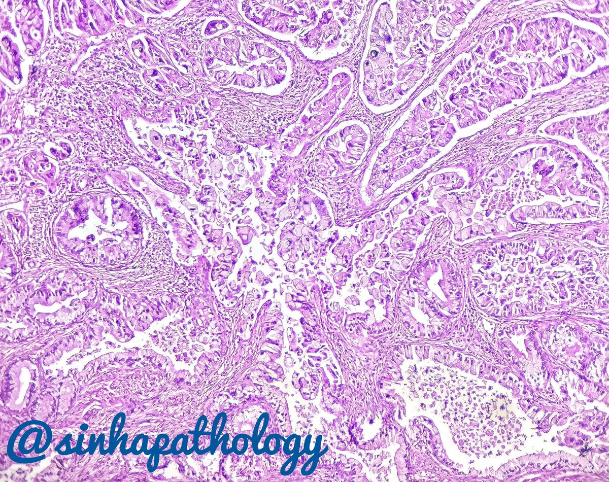 Anshuman Sinha MD tweet media