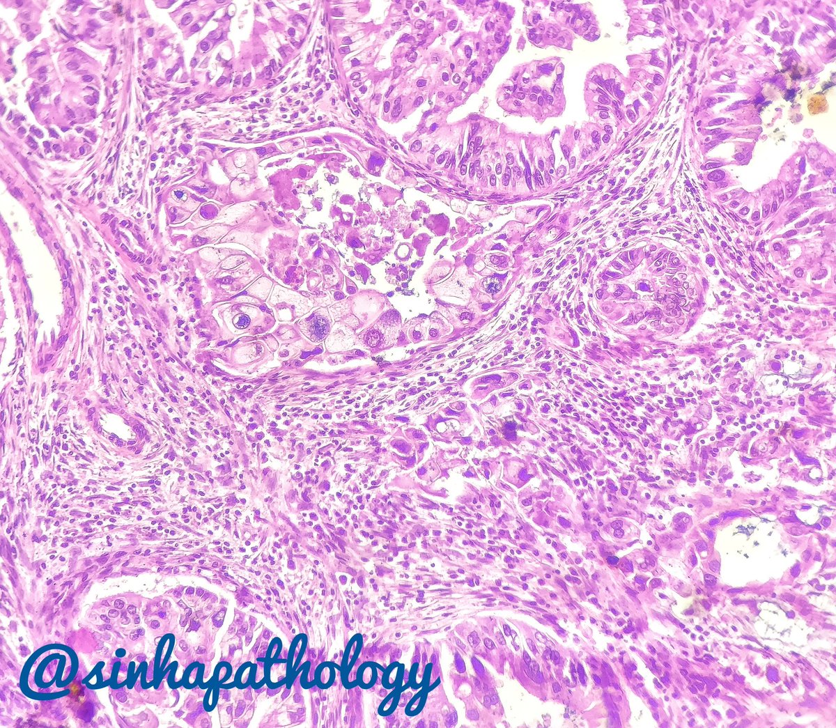 Anshuman Sinha MD tweet media