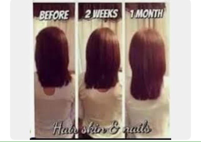 RobynSwaine's tweet photo. ๐ธHAIR๐ธ
Want gorgeous healthy looking hair? TRY our Berry Capsules๐๐๐๐
The main benefits of our Berry Capsules is Skin, Hair& Nails. Other benefits of the product is clearing Acne and Eczema skin conditions๐
#100percentnatural
#hairgoals
#healthynotskinny
#berrycapsules https://t.co/7TQwUX4h18