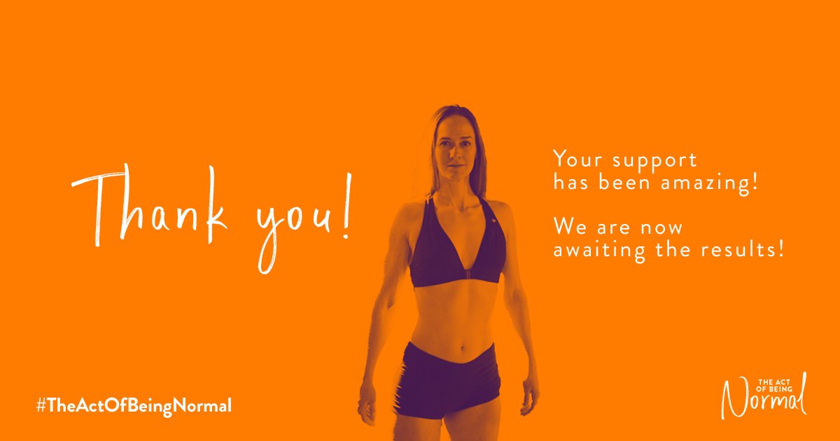 ActingNormalDoc's tweet photo. Thank you for your continuous support these past couple of days 🙌 The voting period is over &amp; we're (somewhat) patiently waiting to hear the results from @STORYHIVE. We will keep you updated, &amp; thanks again! 💜🧡

#TheActofBeingNormal #NormalisBoring #Yeg #LimbLossAwarenessMonth https://t.co/2vsENneKat