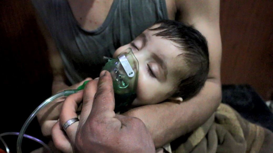 1razan2sy's tweet photo. صور لحالات الاختناق جراء قصف قوات الأسد بالغازات السامة مدنية #دوما. 
#دوما_تختنق
#Domasuffocates https://t.co/fJpbFSif63