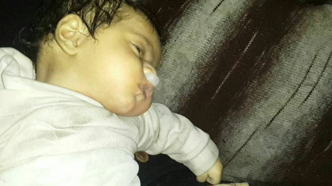 NwarAlahmad's tweet photo. @EmmanuelMacron
@tramp
#Douma 
#United_nations
#Security_Council
#Human_Rights_Organization
Leaders of the civilized world
Damn you.
👇
Cellars full of martyrs and more than a thousand wounded after the targeting of the city of Douma .. Chemical weapons https://t.co/DVB3kDqpwx